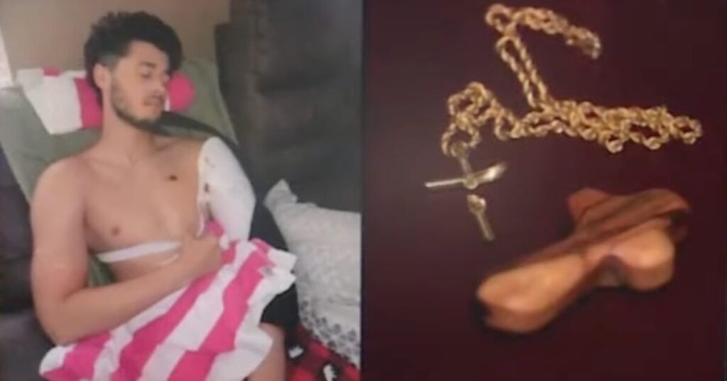 Miracle: Florida Man Gives God Glory After Cross Necklace Blocks Bullet from Hitting Heart