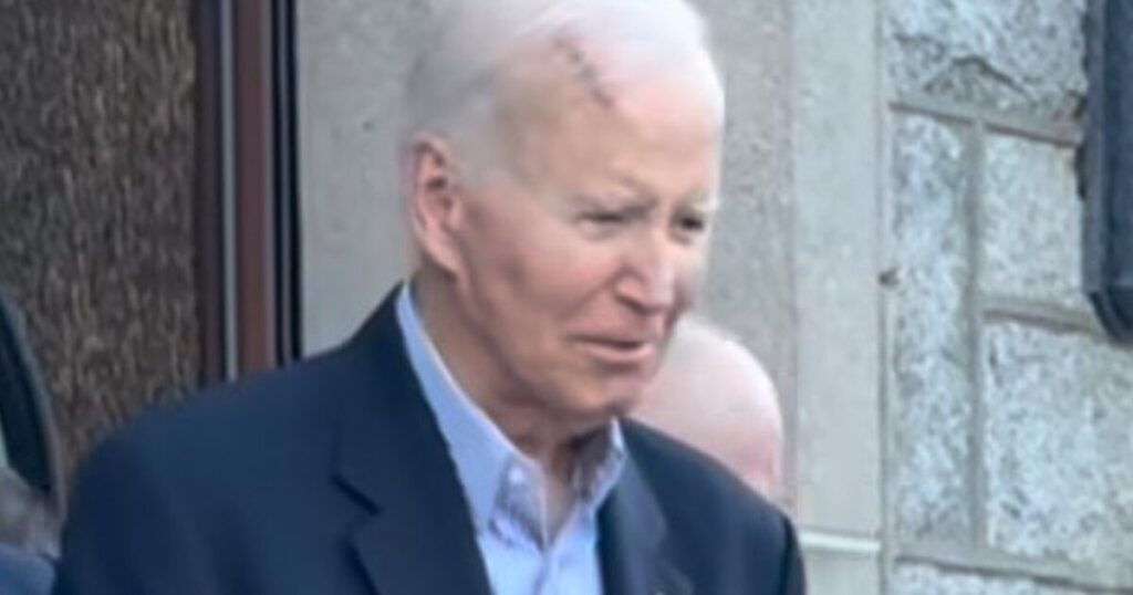 WATCH: Biden Seen with Massive Gash on His Head… Update: Biden Underwent Skin Cancer Surgery