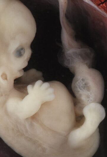 New Bill to Ban Abortion Pill Hits Senate