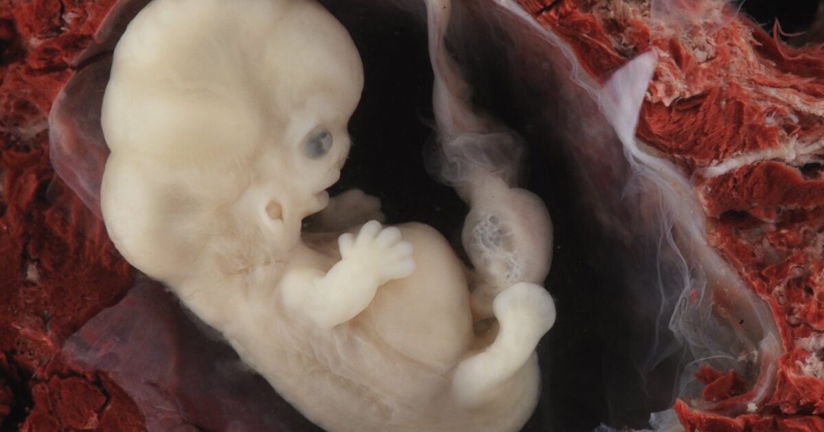 New Bill to Ban Abortion Pill Hits Senate