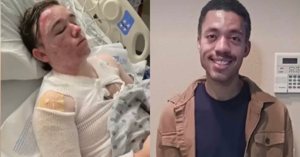 HORROR! 20-Year-Old McDonalds Manager Hospitalized With Third Degree Burns After Employee Threw Hot Oil on Him – “Why Would He Do This to Me?” (VIDEO)