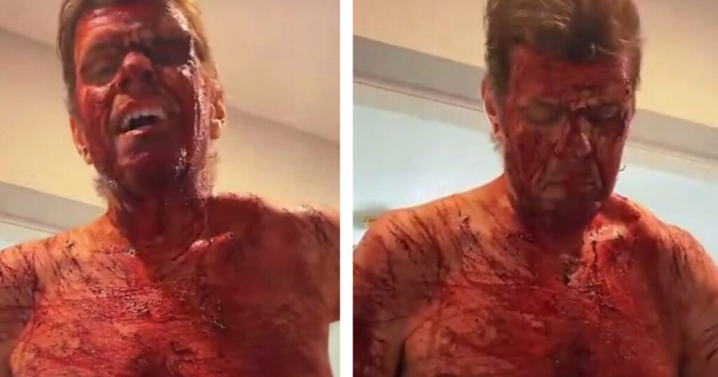 SHOCK: Celebrity Blogger Perez Hilton Self-Harms on TikTok Livestream – Fully Nude, Covered in Blood
