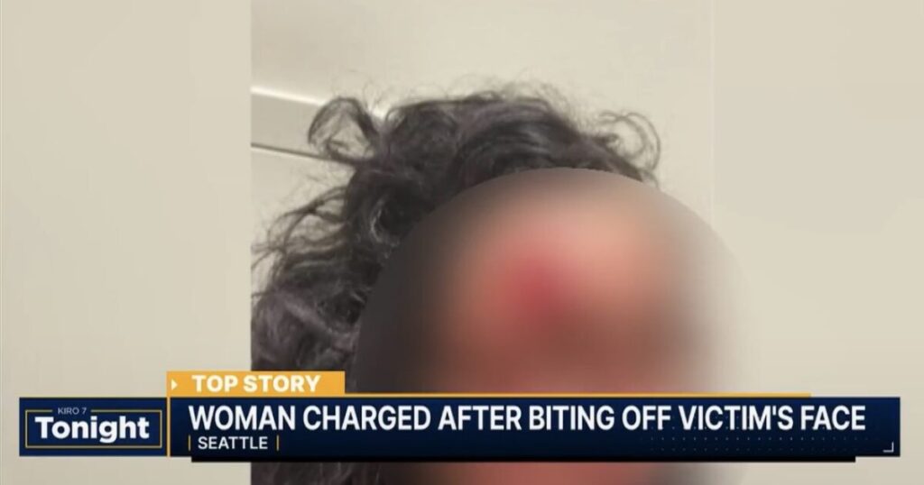 HORROR: ‘Zombie’ Attacker Bites Chunk of Woman’s Face Off in Seattle in Racially Motivated Attack